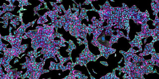 Das dreifarbige Gebilde auf schwarzem Grund soll einen Zellzustand darstellen. Das Gewebe selbst ist transparent lila mit blauen kreisförmigen Punkten. Das Gewebe wird am eigenen Rand grünlich.